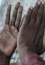 Close up of two hands, palms facing